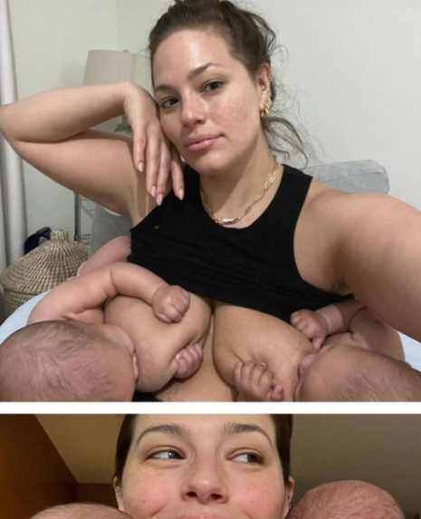 A Woman Shows The Raw Truth Of Postpartum Bodies..